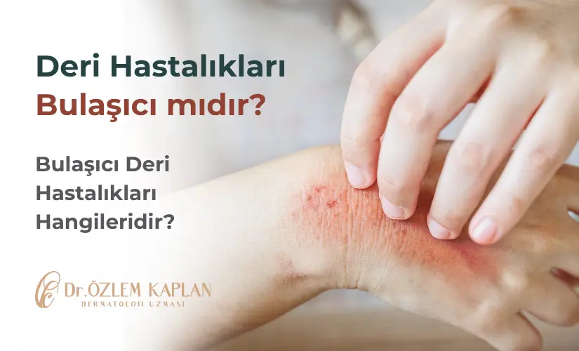 Deri Hastalıkları Bulaşıcı mıdır? Bulaşıcı Deri Hastalıkları Hangileridir? | Dermatoloji Uzmanı Dr. Özlem Kaplan