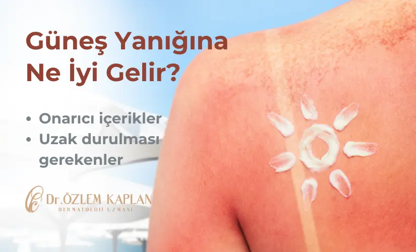 Güneş Yanığına Ne İyi Gelir? | Dermatolog Dr. Özlem Kaplan