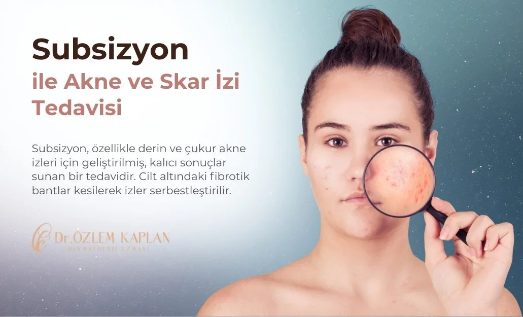 Subsizyon ile Akne ve Skar İzi Tedavisi Samsun