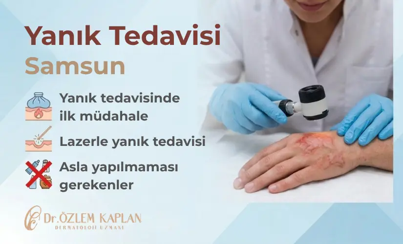 Yanık Tedavisi Samsun
