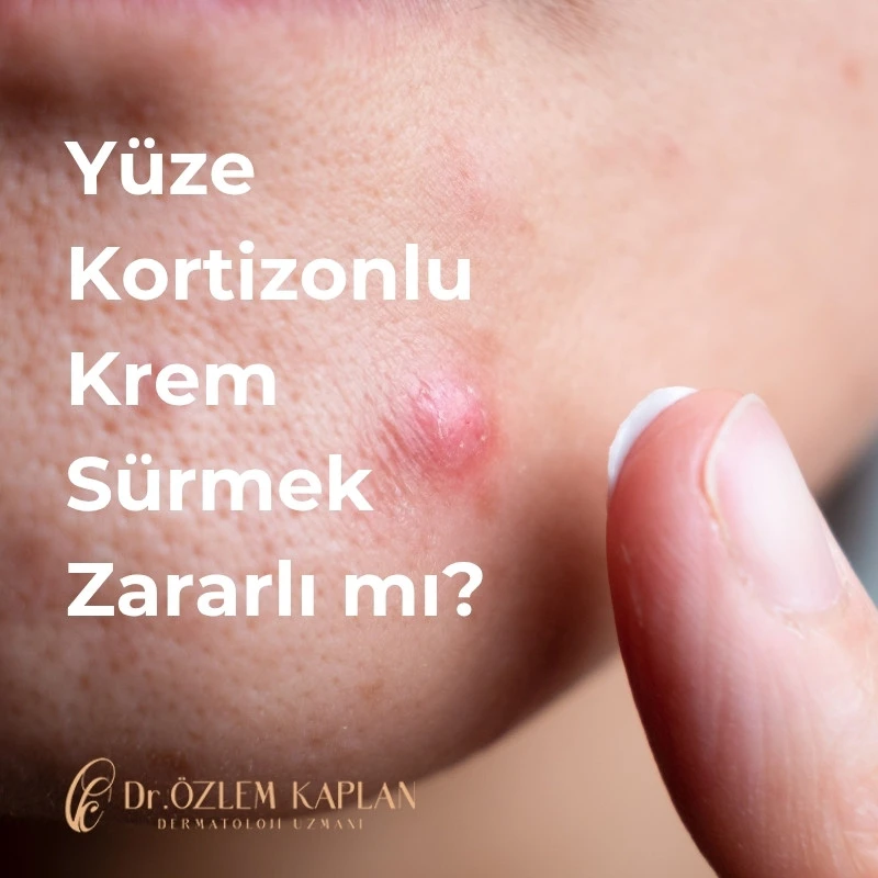 Yüze Kortizonlu Krem Sürmek Zararlı mı? Ne Zaman Kullanılmalı?