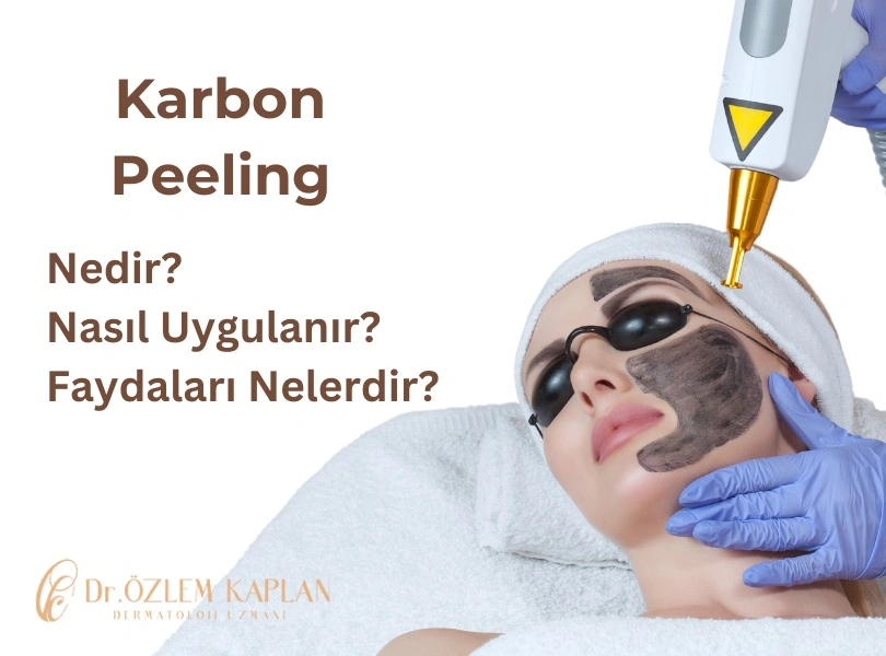 Karbon Peeling Nedir? Karbon Peeling Fiyatları, Samsun, Atakum