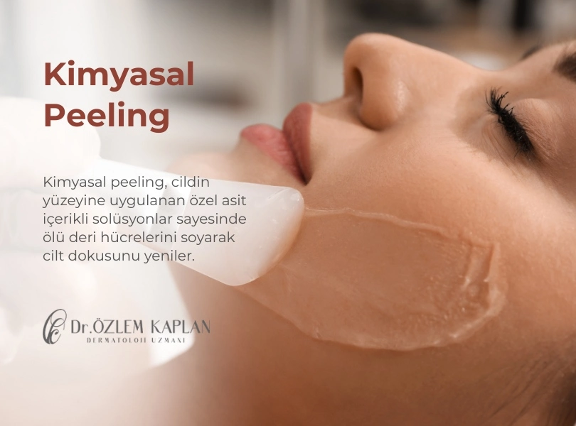 Kimyasal Peeling Nedir? Kimyasal Peeling Fiyatları, Samsun, Atakum